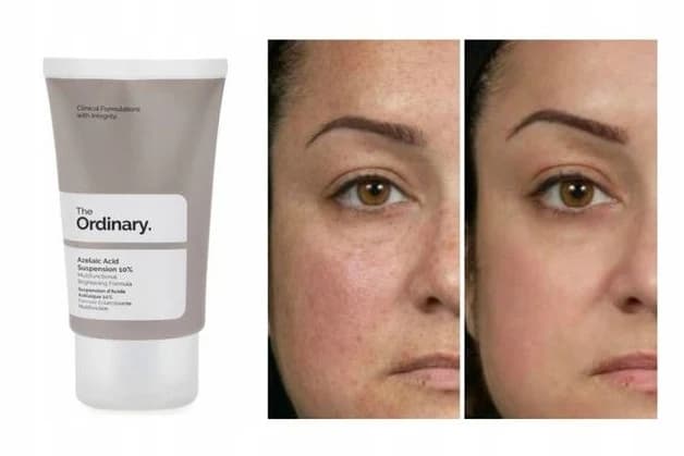 Kwas The Ordinary 10 % 30 ml 3